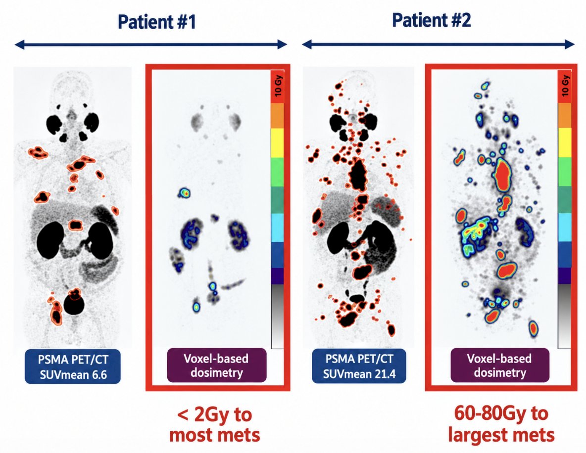 ProsTIC26: Appropriate Use of Lutetium PSMA in 2026