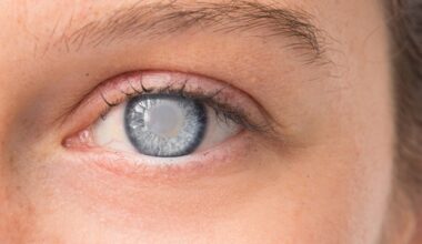 Simple eye test identifies patients suitable for laser blended vision
