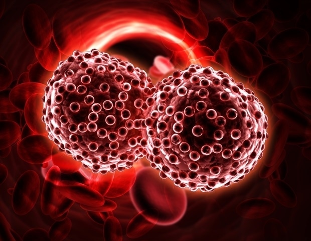 Pneumococcal disease may signal undiagnosed blood cancer