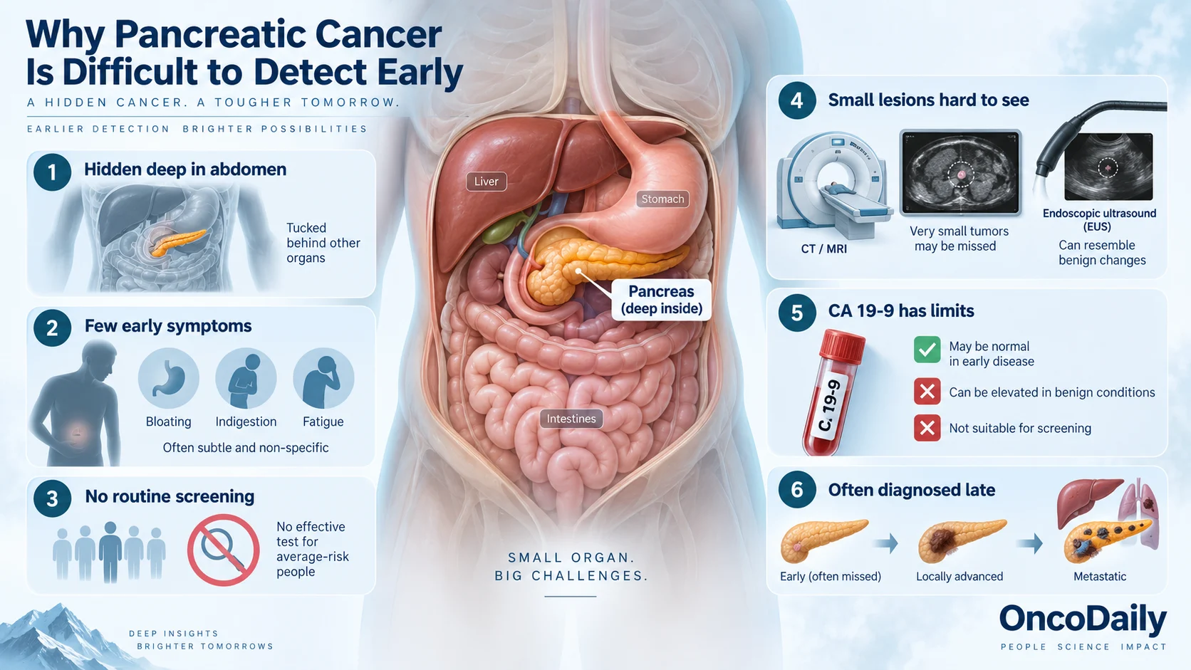 Can Pancreatic Cancer Be Detected Early? Symptoms, Biomarkers, and New Tests 5 Can Pancreatic Cancer Be Detected Early? Symptoms, Biomarkers, and New Tests
