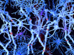 A photo shows white matter in the brain.
