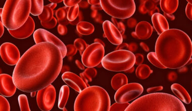 New MS cell therapy builds immune tolerance to protect myelin