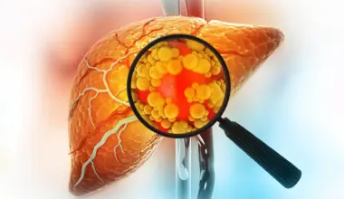 Scientists discover a hidden problem with this popular sugar substitute