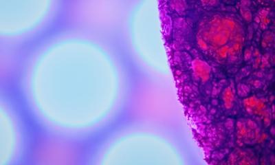 Parkinson's disease: clues in the gut microbiome • healthcare-in-europe.com