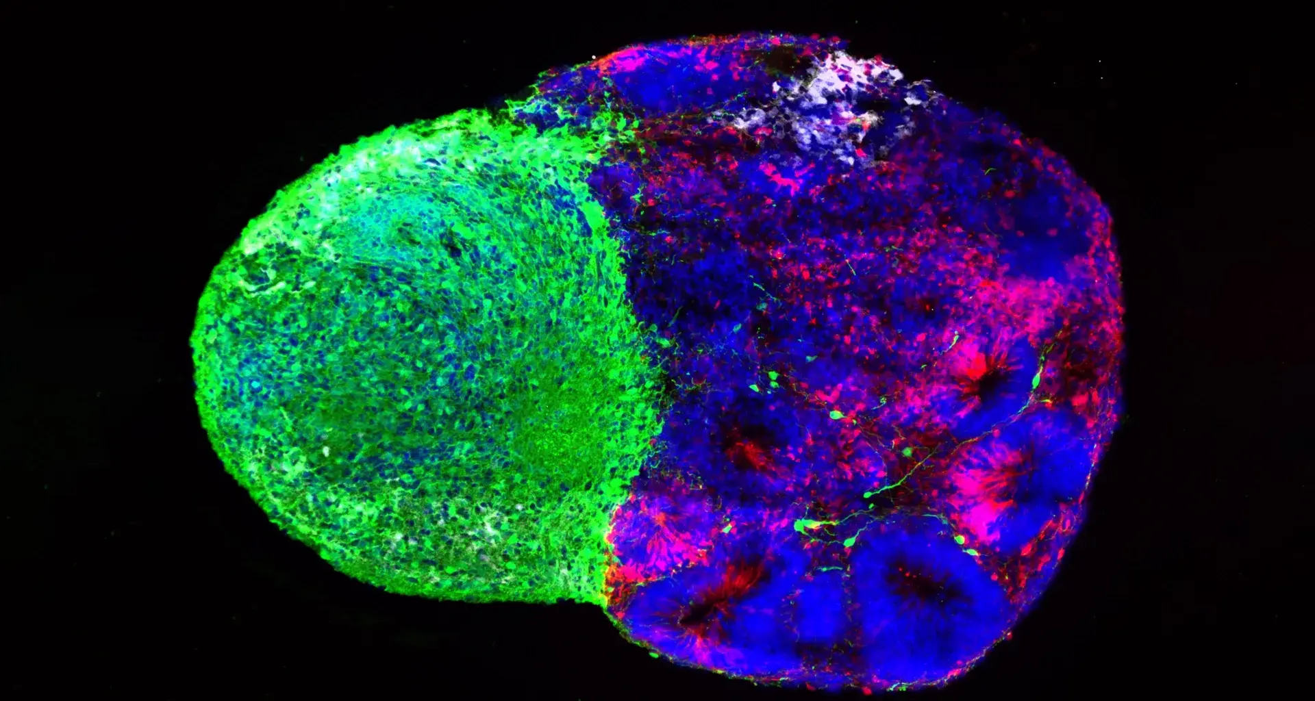 Scientists reveal the hidden instructions that build the human brain