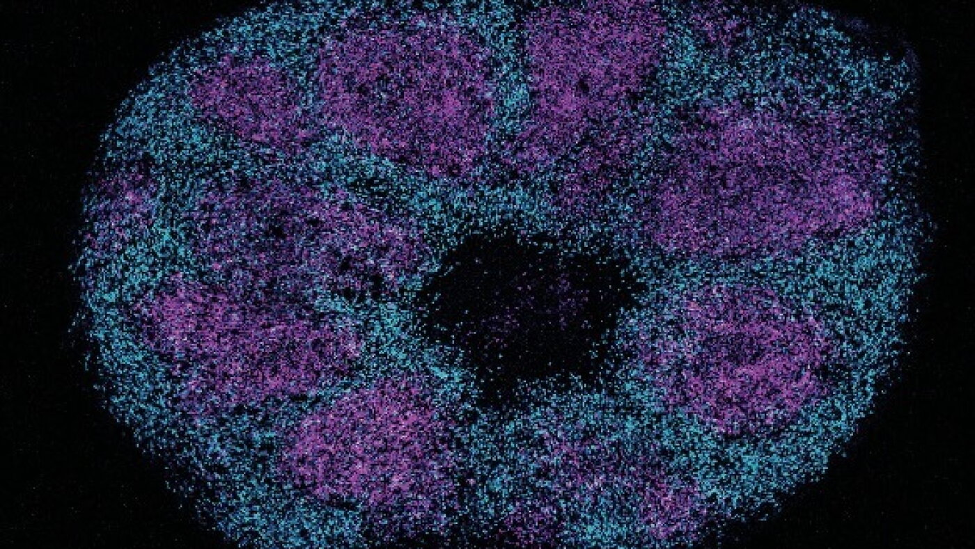 Scientists map key protein interactions linked with profound autism : NPR