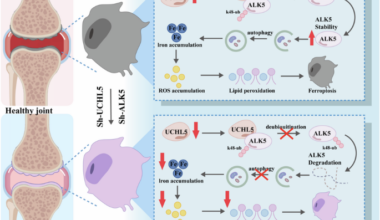 UCHL5 stabilizes ALK5 to promote autophagy dependent ferroptosis in osteoarthritis