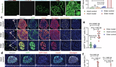 SARS-CoV-2 seeds IAPP aggregation and β-cell failure