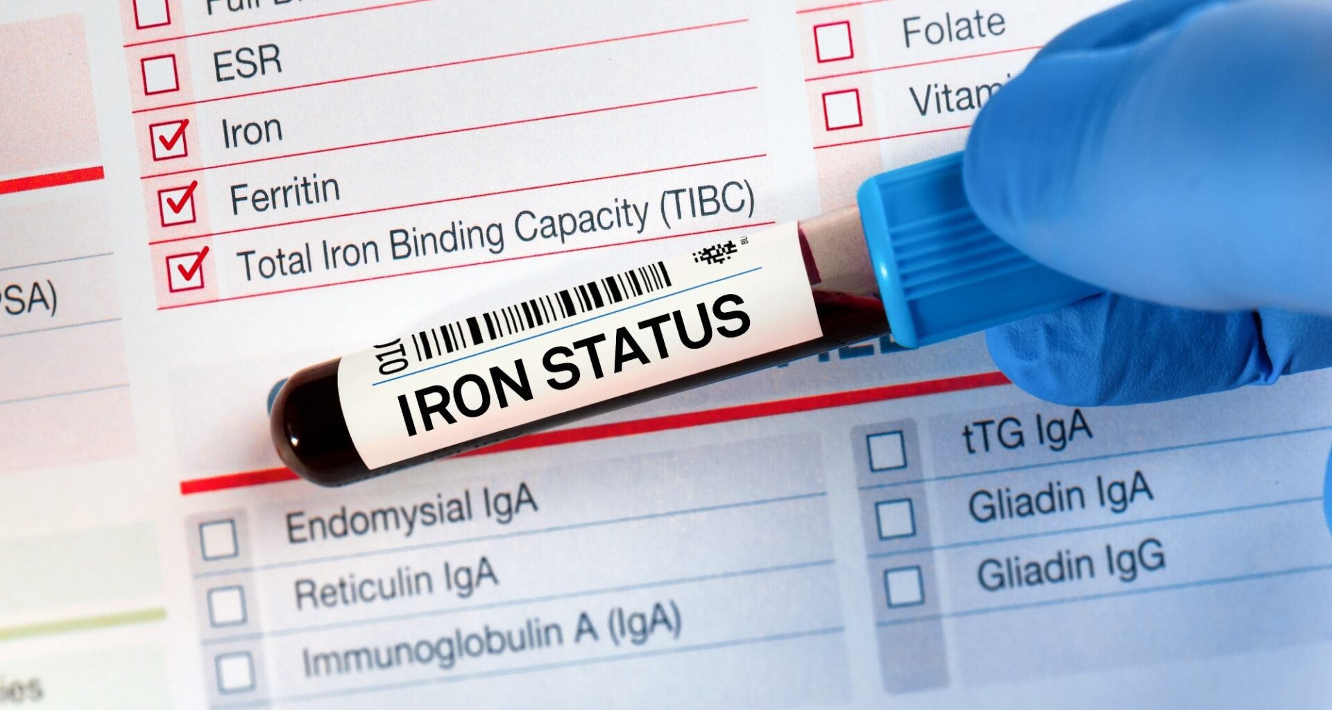 Blood sample tube for analysis of Iron Status Tests. Blood tube test with requisition form for Iron status Test