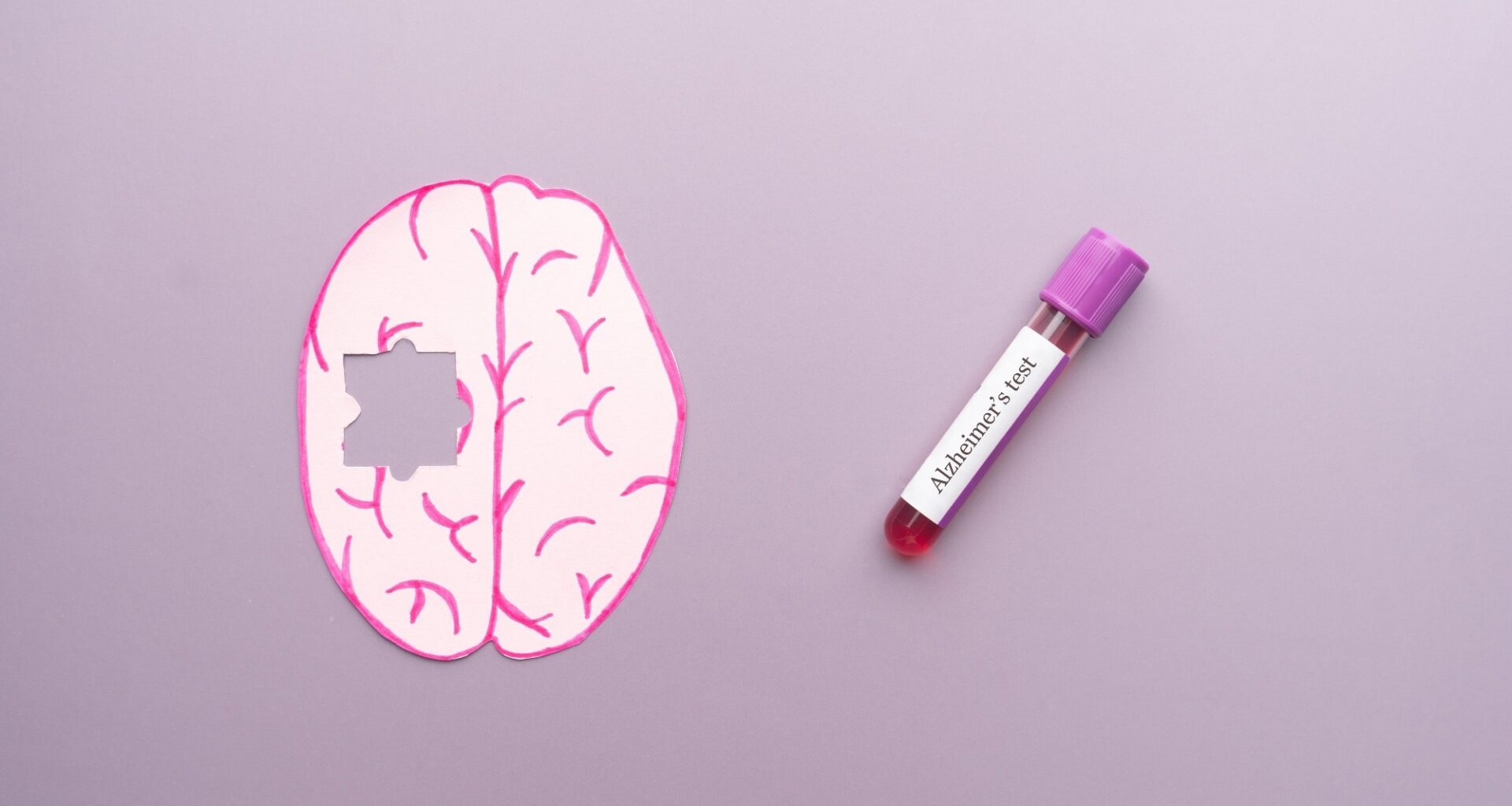 A study links a blood protein to memory and brain changes in Down syndrome
