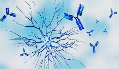 Nearly one in three women with autoimmune diseases waited at least four years for a diagnosis, survey finds