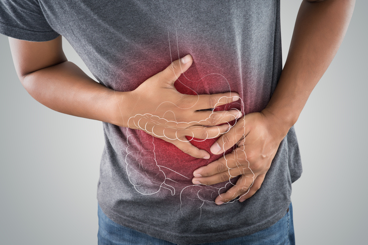 JAK Inhibitors and Reduction of Colectomy Risk for Patients With Acute Severe Ulcerative Colitis