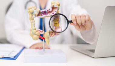 Physician holding magnifying glass to 3D colon model.