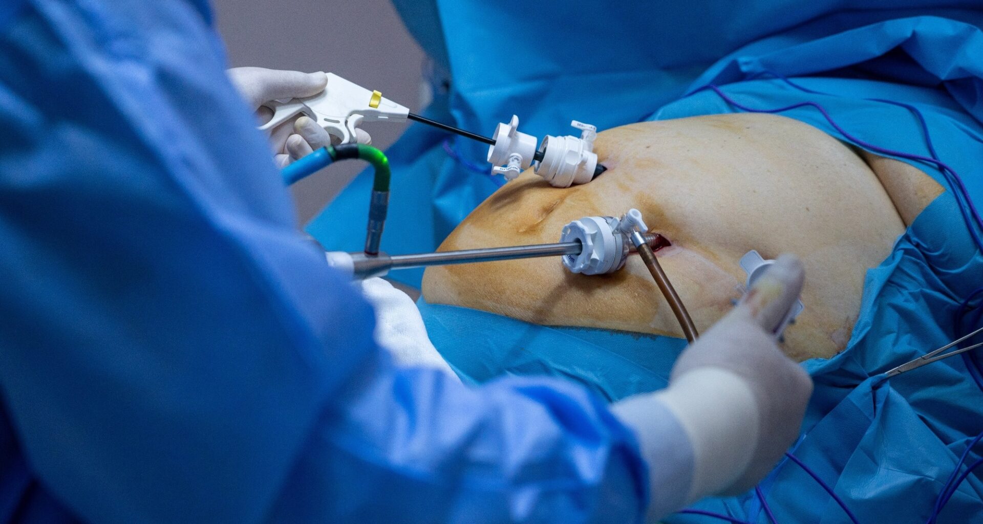 Study: Associations of postoperative vitamin D with body composition changes after bariatric surgery: a prospective cohort study. Image Credit: Subway84 / Shutterstock