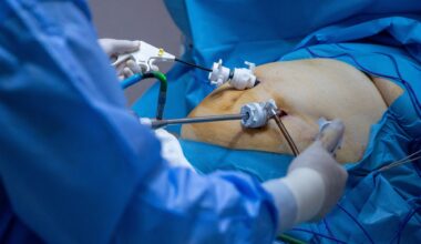 Study: Associations of postoperative vitamin D with body composition changes after bariatric surgery: a prospective cohort study. Image Credit: Subway84 / Shutterstock