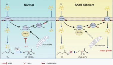 Fatty acid 2-hydroxylation restrains gastric cancer by blocking CD36 palmitoylation and fatty acid uptake