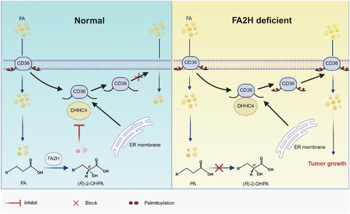 Fatty acid 2-hydroxylation restrains gastric cancer by blocking CD36 palmitoylation and fatty acid uptake