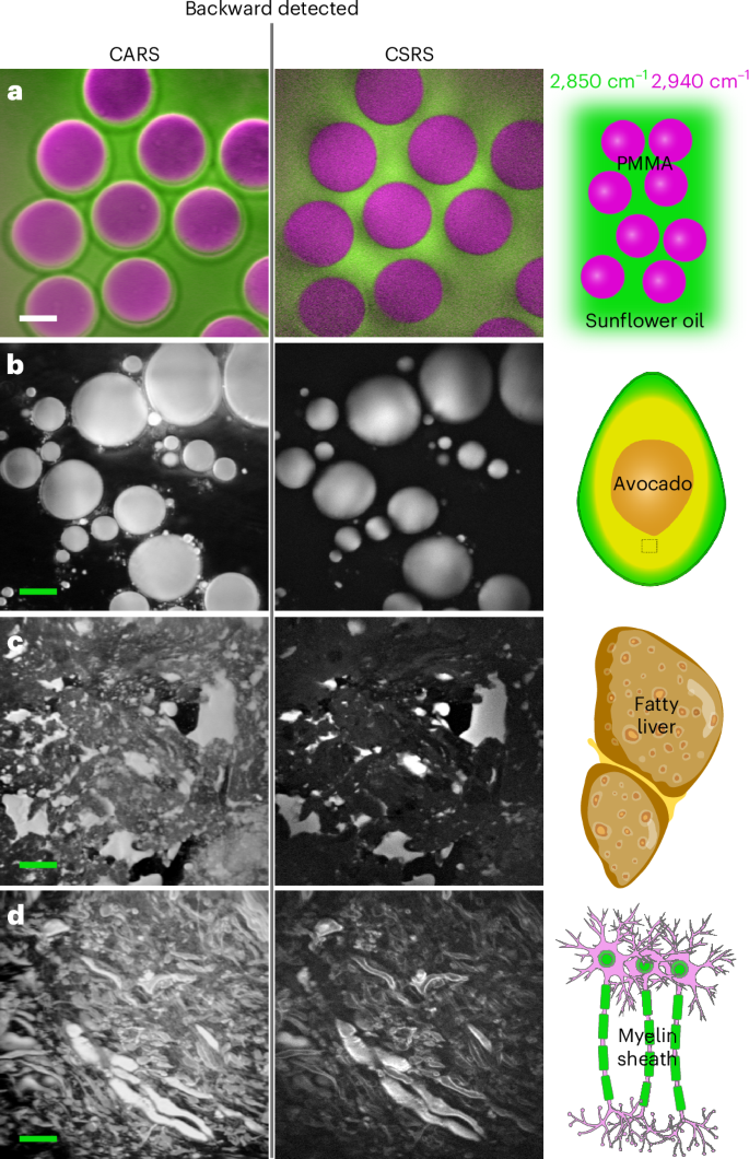 Fig. 4: Experimental comparison of epi-CARS and backscattered CSRS imaging.