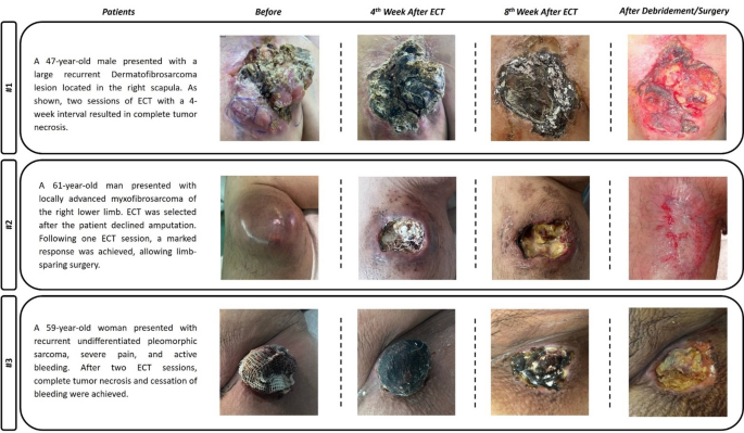 Fig. 4