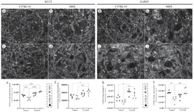 Newswise: KCC2 modulation improves neuromuscular function in dystrophic mice