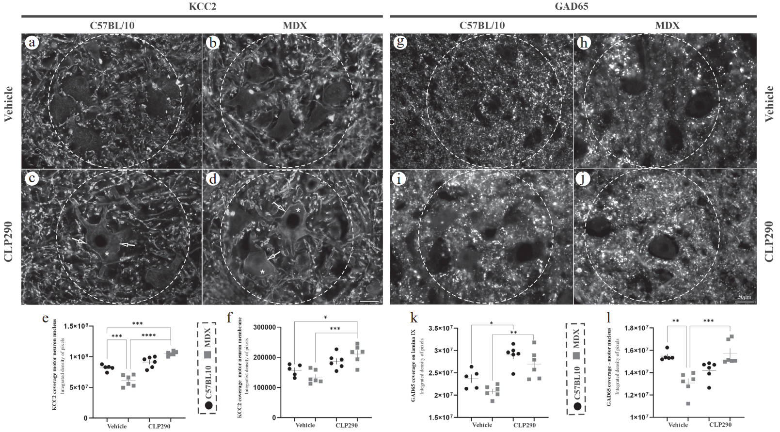 Newswise: KCC2 modulation improves neuromuscular function in dystrophic mice