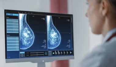AI Helps Close Breast Cancer’s Deadliest Gaps