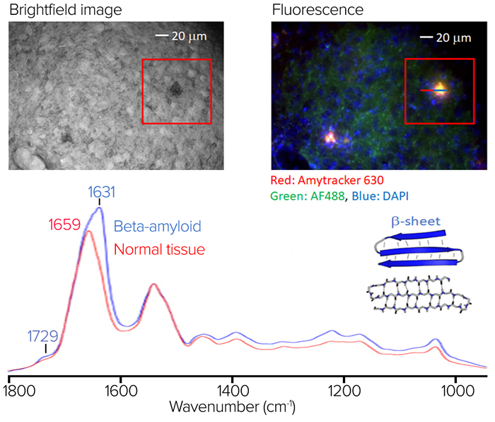 Brightfield vs fluorescence imaging