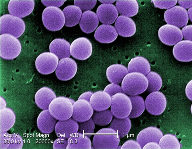 Topical peptide spray outperforms placebo in healing burn wounds