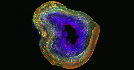 Human brain organoids come of age—but still have room to grow