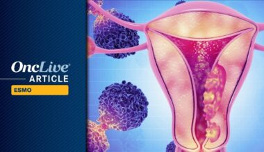 Durvalumab Plus Olaparib Improves Numerical OS in Advanced Endometrial Cancer