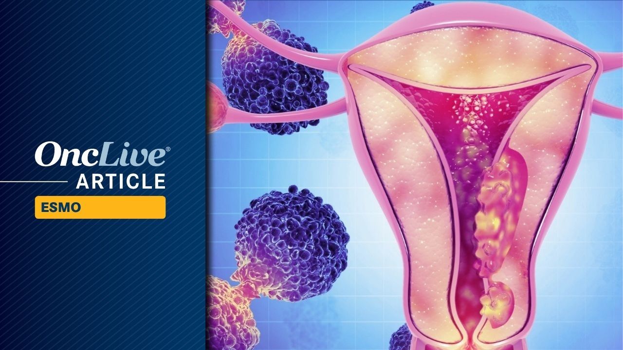 Durvalumab Plus Olaparib Improves Numerical OS in Advanced Endometrial Cancer