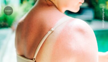 Moderna mRNA vaccine almost halves the risk of skin cancer returning