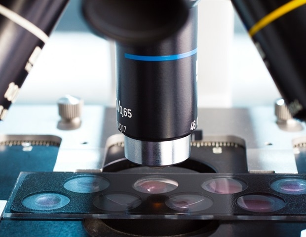 New SPARCS technology combines AI and microscopy to screen cells