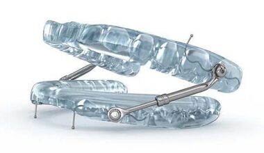 For sleep apnea, a dental device may be as effective as CPAP