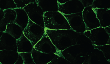Finding Their Sense of Direction: Cell Movement Helps Tissues Establish Polarity