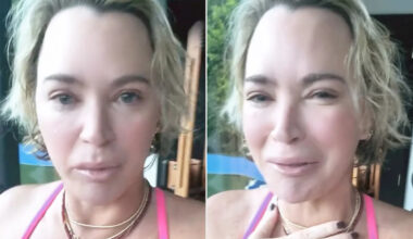 Teddi Mellencamp Says Brain Surgery Left Her Struggling to Write and See: ‘I Don’t Want to Keep Feeling Sorry for Myself’