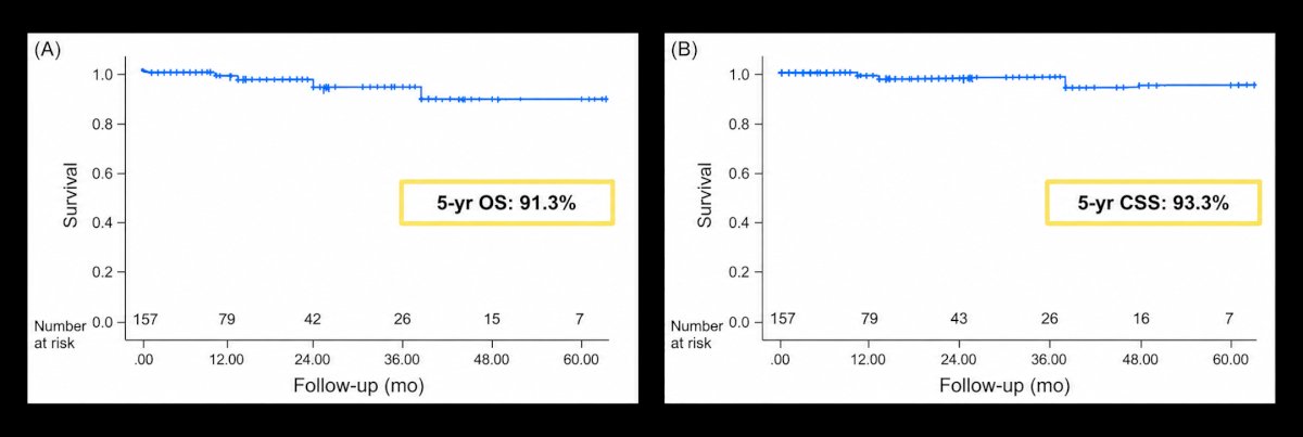 Transitioning to the expanding indications for partial nephrectomy, Dr. Derweesh highlighted work from his group and a multicenter study by Yim et al [27] evaluating outcomes of robot-assisted partial nephrectomy for clinical T3a renal masses. Clinical T3a disease has traditionally been considered a strong indication for radical nephrectomy, particularly when tumors demonstrate invasion into perinephric tissues or venous structures. The multicenter analysis included 157 patients undergoing robot-assisted partial nephrectomy for clinical T3a RCC. The 5-year overall survival was 91.3% and 5-year cancer-specific survival was 93.3%: