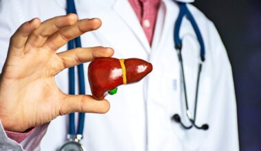 Exercise rewires liver metabolism differently based on sex