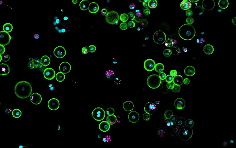 Cells seen on a microscope slide