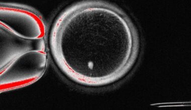 Scientists find way to fertilise eggs made from genetic material of skin cells