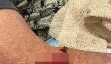 SunLive - 79yo injured man among dog attack victims