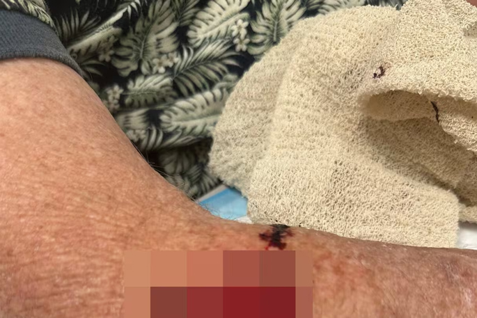 SunLive - 79yo injured man among dog attack victims