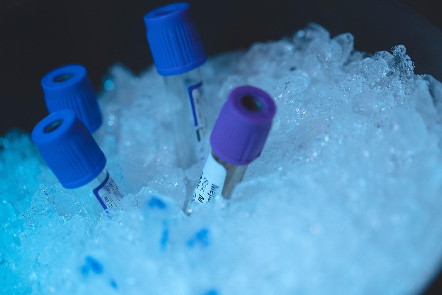 Photo: University of Malta ALS/MND Lab