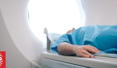 Hospital radiology scan rates 'grim', APEX union says