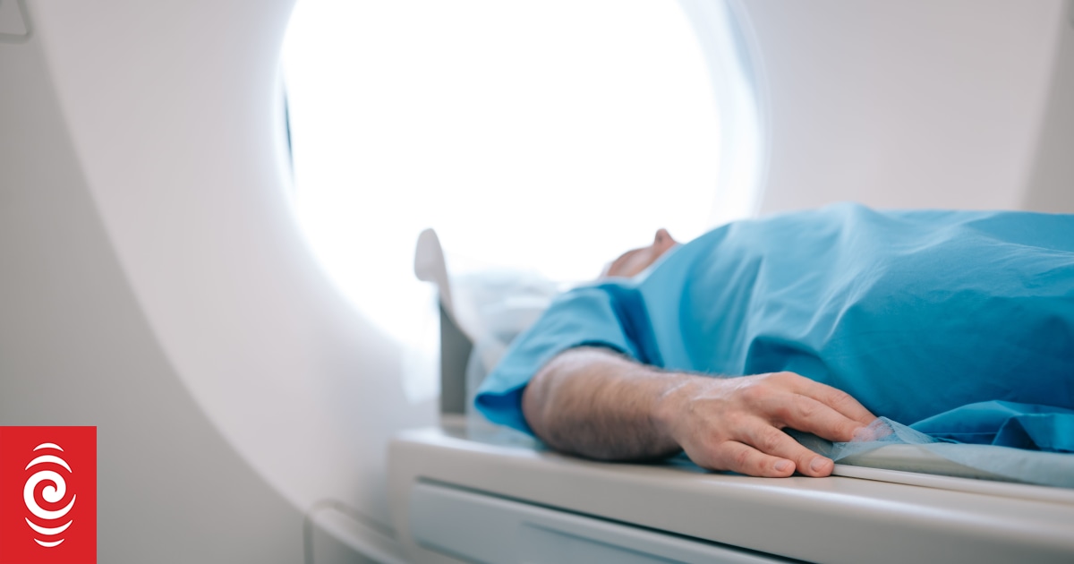 Hospital radiology scan rates 'grim', APEX union says