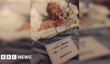 Grandmother’s warning after losing fingers and toes to sepsis