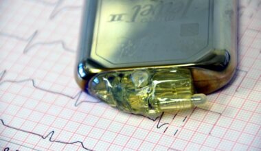 Chilean researchers replicate heart’s electrical system