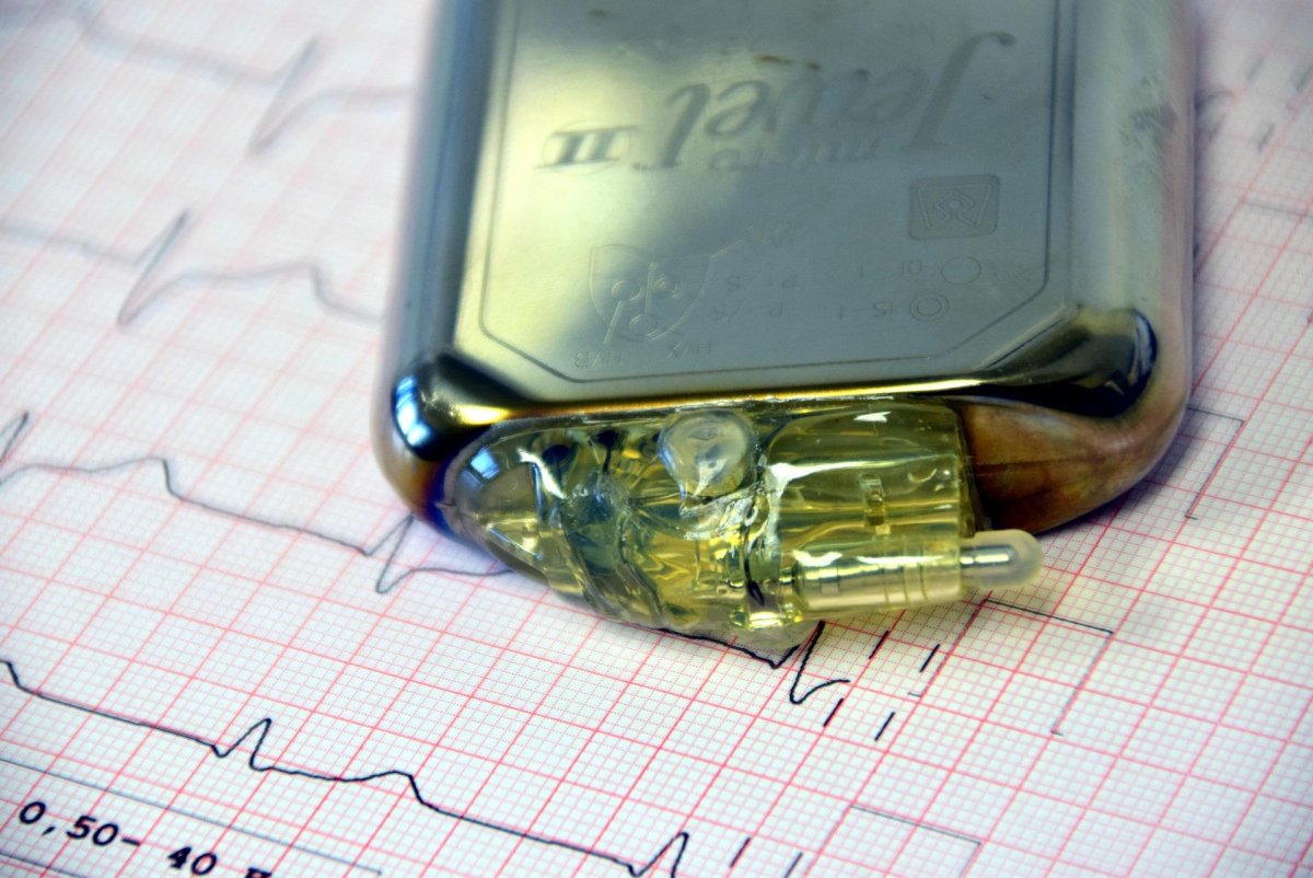 Chilean researchers replicate heart’s electrical system