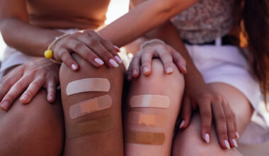 Keloid risk genes open door to better therapy