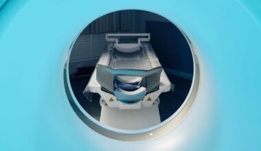CT scanners secretly waste more energy than used by a typical household – but there’s a fix